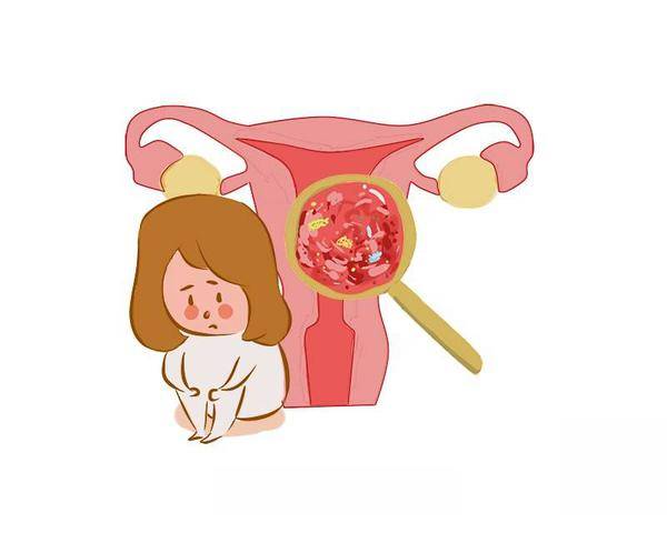 女子长期月经不调查出子宫内膜癌